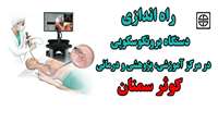 راه اندازي دستگاه ویدیو برونكوسكوپ Full Hd در مرکز آموزشی، پژوهشی و درمانی کوثر سمنان